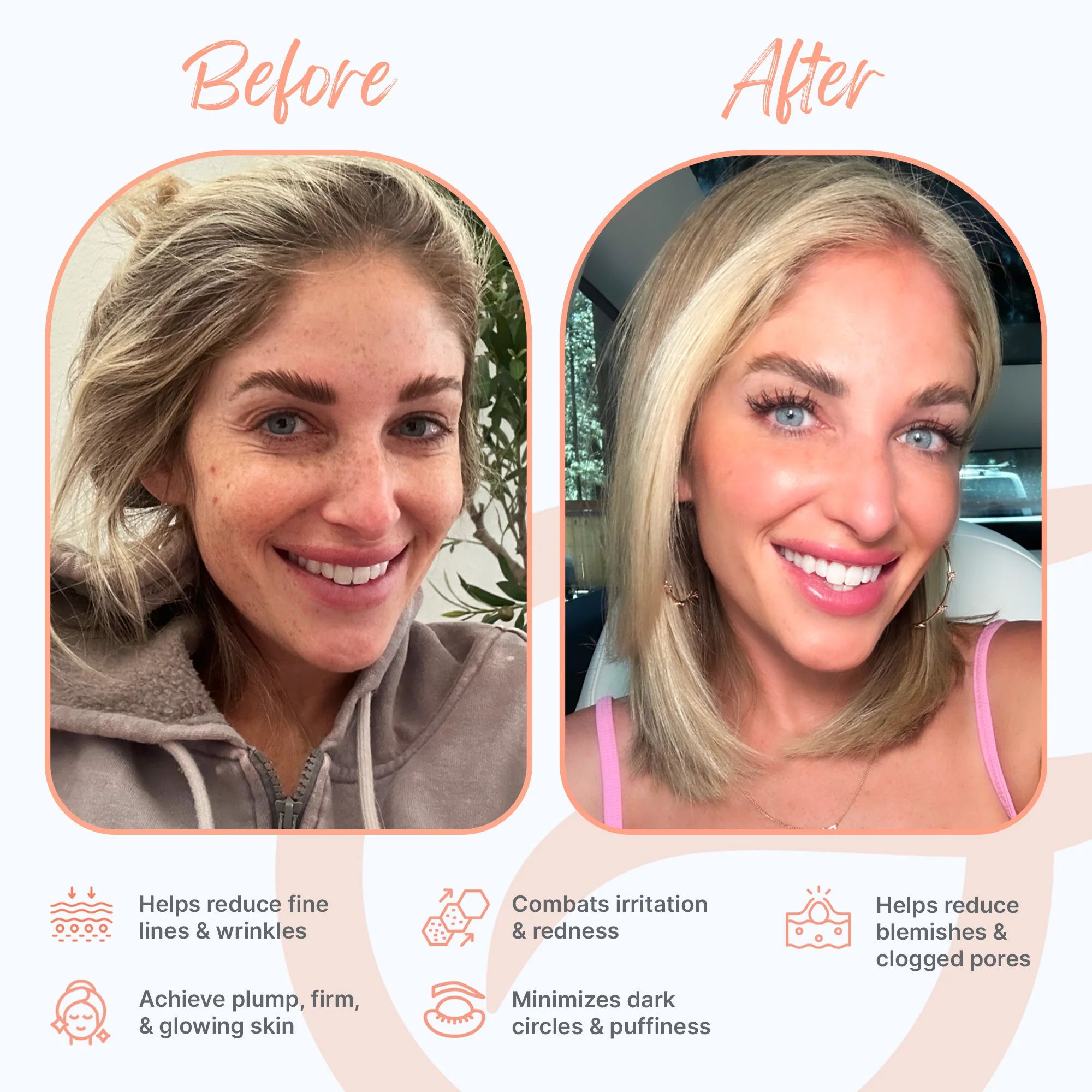 GlowUp™ LED Light Therapy Face Mask